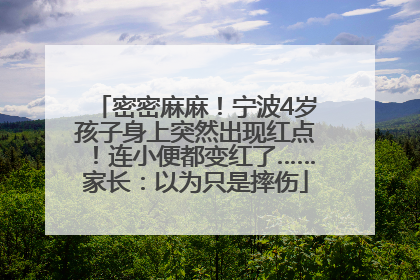 密密麻麻！宁波4岁孩子身上突然出现红点！连小便都变红了……家长：以为只是摔伤
